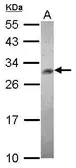 Anti-CHAC1 antibody [N1C3] used in Western Blot (WB). GTX120775