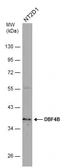 Anti-DBF4B antibody used in Western Blot (WB). GTX120796