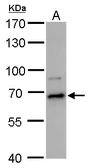 Anti-DDX52 antibody used in Western Blot (WB). GTX120797