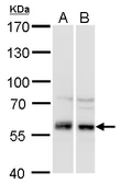 Anti-DYNC1LI1 antibody used in Western Blot (WB). GTX120806