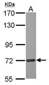 Anti-SELB antibody [C1C3] used in Western Blot (WB). GTX120807