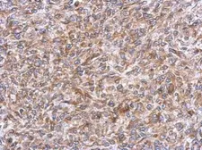 Anti-ERLIN1 antibody used in IHC (Paraffin sections) (IHC-P). GTX120815