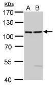 Anti-EXOC2 antibody [C2C3], C-term used in Western Blot (WB). GTX120818