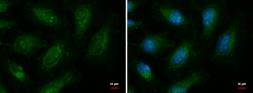 Anti-EXOC8 antibody used in Immunocytochemistry/ Immunofluorescence (ICC/IF). GTX120819