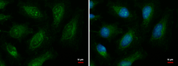 Anti-EXOC8 antibody used in Immunocytochemistry/ Immunofluorescence (ICC/IF). GTX120819
