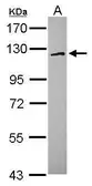 Anti-FAM120A antibody used in Western Blot (WB). GTX120824