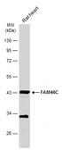 Anti-FAM46C antibody used in Western Blot (WB). GTX120834