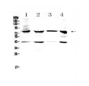 Anti-HSD17B4 antibody used in Western Blot (WB). GTX12084