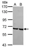 Anti-GRHL1 antibody [C1C3] used in Western Blot (WB). GTX120855