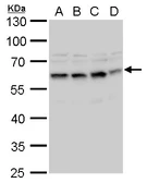 Anti-STCH antibody used in Western Blot (WB). GTX120858