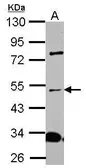 Anti-ALS2CR15 antibody used in Western Blot (WB). GTX120861