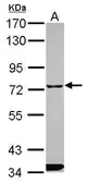 Anti-ITPRIPL1 antibody [C1C3] used in Western Blot (WB). GTX120868