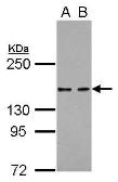 Anti-KDM6A antibody [C2C3], C-term used in Western Blot (WB). GTX120873