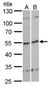 Anti-KHDRBS3 antibody used in Western Blot (WB). GTX120874