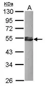 Anti-KLF17 antibody used in Western Blot (WB). GTX120877