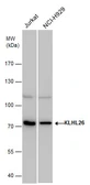 Anti-KLHL26 antibody used in Western Blot (WB). GTX120879
