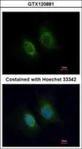 Anti-Keratin 36 antibody used in Immunocytochemistry/ Immunofluorescence (ICC/IF). GTX120881