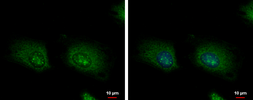 Anti-LARP1 antibody used in Immunocytochemistry/ Immunofluorescence (ICC/IF). GTX120883