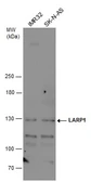 Anti-LARP1 antibody used in Western Blot (WB). GTX120884