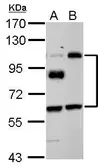 Anti-EPLIN antibody used in Western Blot (WB). GTX120889