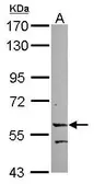 Anti-LRRC15 antibody [N1N3] used in Western Blot (WB). GTX120895