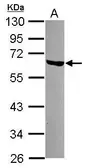 Anti-LSM14A antibody [N3C3] used in Western Blot (WB). GTX120902