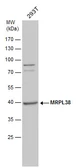 Anti-MRPL38 antibody used in Western Blot (WB). GTX120918