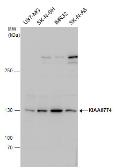 Anti-MTUS2 antibody used in Western Blot (WB). GTX120919