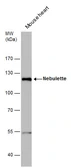 Anti-Nebulette antibody used in Western Blot (WB). GTX120922