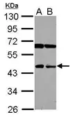 Anti-NEU4 antibody [N3C3] used in Western Blot (WB). GTX120923