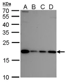 Anti-NIP7 antibody used in Western Blot (WB). GTX120926