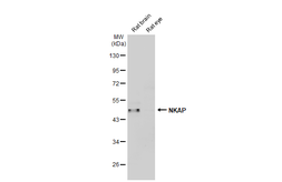 Anti-NKAP antibody used in Western Blot (WB). GTX120929