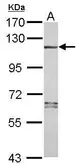Anti-NLRP7 antibody [N3C2], Internal used in Western Blot (WB). GTX120931