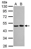 Anti-NOB1 antibody [N1N3] used in Western Blot (WB). GTX120935