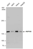 Anti-NUP155 antibody [C1C3] used in Western Blot (WB). GTX120945