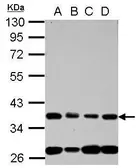 Anti-Nup53 antibody [N3C3] used in Western Blot (WB). GTX120947