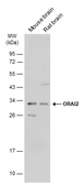Anti-ORAI2 antibody used in Western Blot (WB). GTX120952
