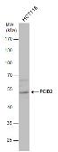 Anti-PCID2 antibody used in Western Blot (WB). GTX120963