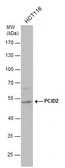 Anti-PCID2 antibody used in Western Blot (WB). GTX120963