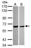 Anti-PYROXD2 antibody [N3C3] used in Western Blot (WB). GTX120980