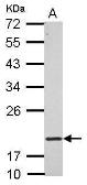 Anti-RNF5 antibody used in Western Blot (WB). GTX121006