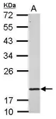 Anti-RNF5 antibody used in Western Blot (WB). GTX121006