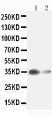 Anti-Arginase 1 antibody used in Western Blot (WB). GTX12102