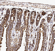 Anti-SSR3 antibody used in IHC (Paraffin sections) (IHC-P). GTX12103