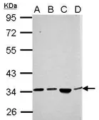 Anti-SH3YL1 antibody used in Western Blot (WB). GTX121041
