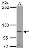 Anti-SLITRK5 antibody [N1N2], N-term used in Western Blot (WB). GTX121057