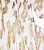 Anti-Myoglobin antibody used in IHC (Paraffin sections) (IHC-P). GTX12106