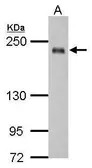 Anti-SSFA2 antibody used in Western Blot (WB). GTX121070