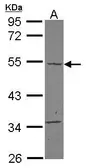 Anti-Carabin antibody [N1C1] used in Western Blot (WB). GTX121080