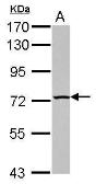 Anti-TBC1D15 antibody [N1N2], N-term used in Western Blot (WB). GTX121082